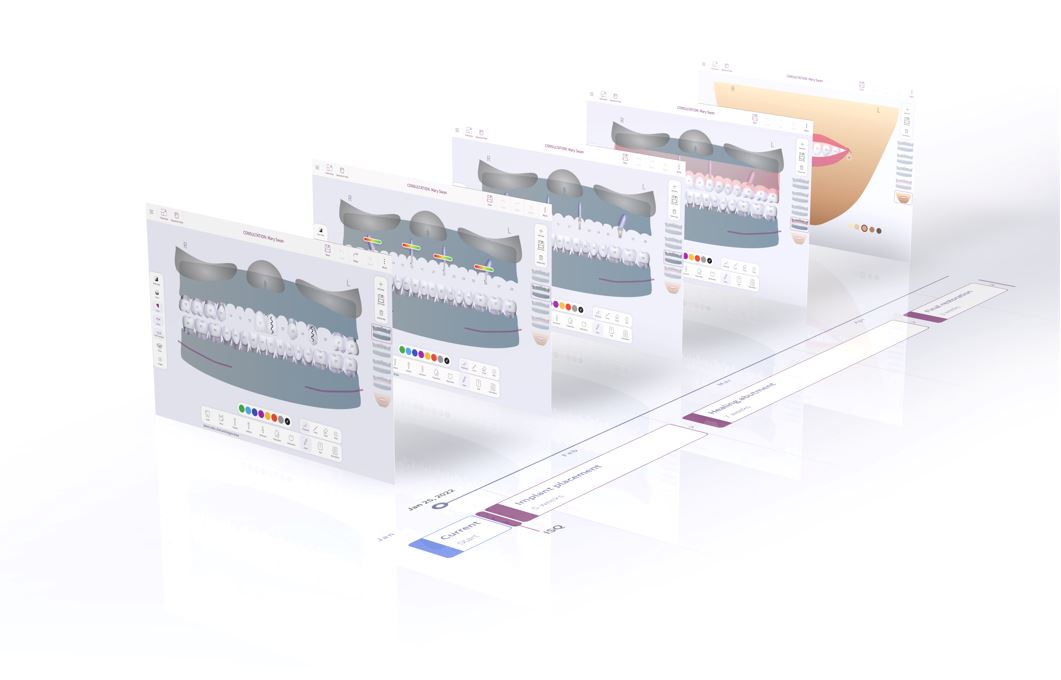 ConsultationTool-Timeline